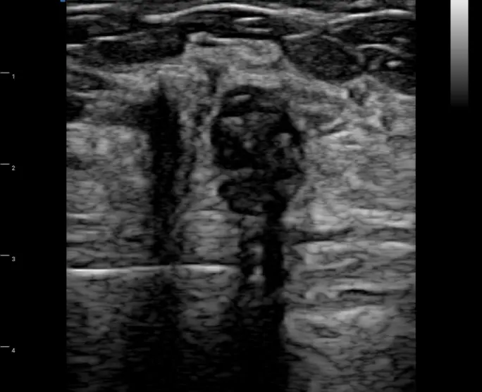 Bezprzewodowy ultrasonograf
